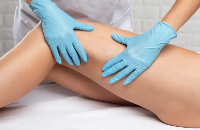 Vein Vascular Removal